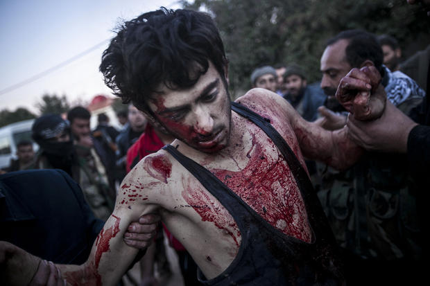 Syria_-injured.jpg 