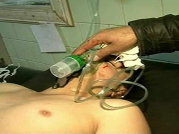 An image from Syrian state television shows a man being treated in an Aleppo province hospital after an alleged chemical weapons attack 