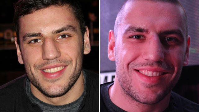 lucic-before-and-after.jpg 