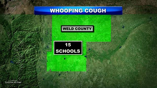 WELD CO WHOOPING COUGH map 