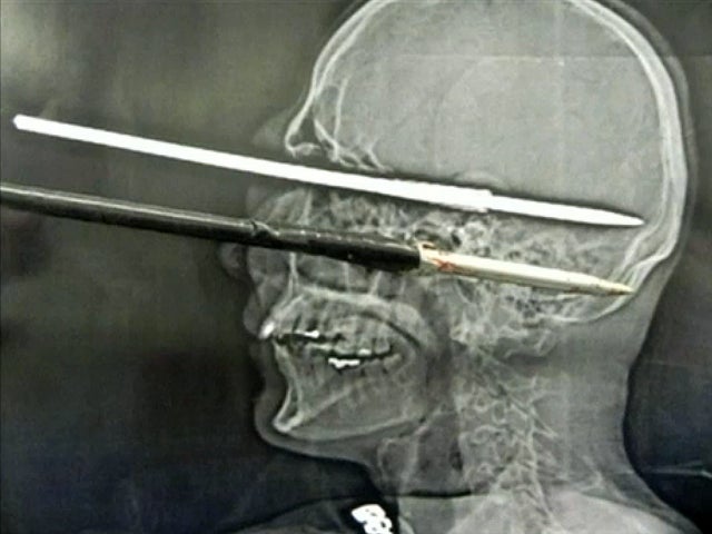 XraywithHarpoon.jpg 
