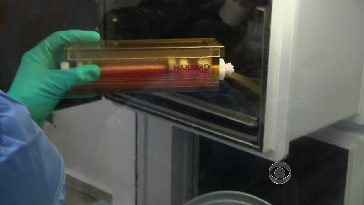 Twoyearold gets windpipe made from her own stem cells CBS News