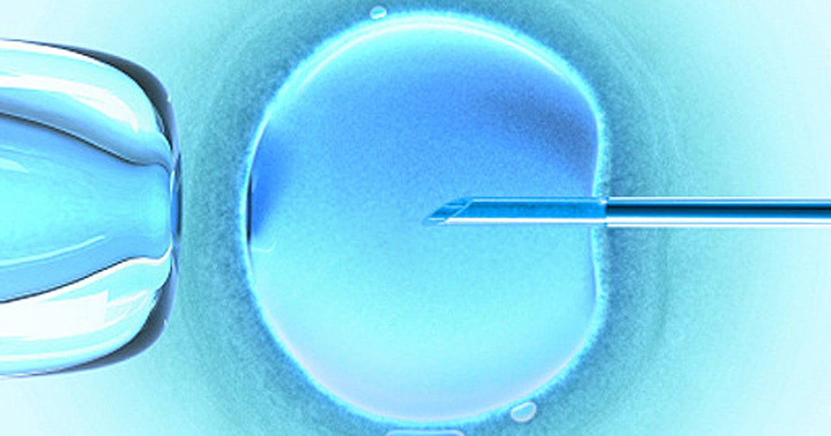IVF children may have higher chance of autism CBS News