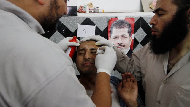 A wounded supporter of Egypt's ousted President Mohamed Morsi receives treatment at a local hospital in Cairo 