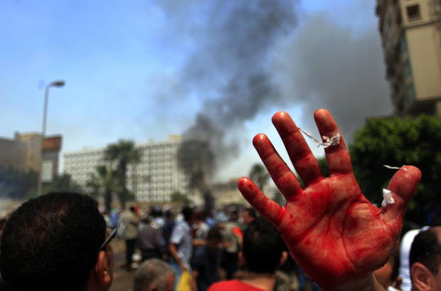 A supporter of Egypt's ousted President Mohammed Morsi shows his blood-stained hand as supporters clash with the Egyptian security forces 