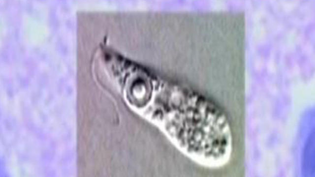 amoeba-600x450.jpg 