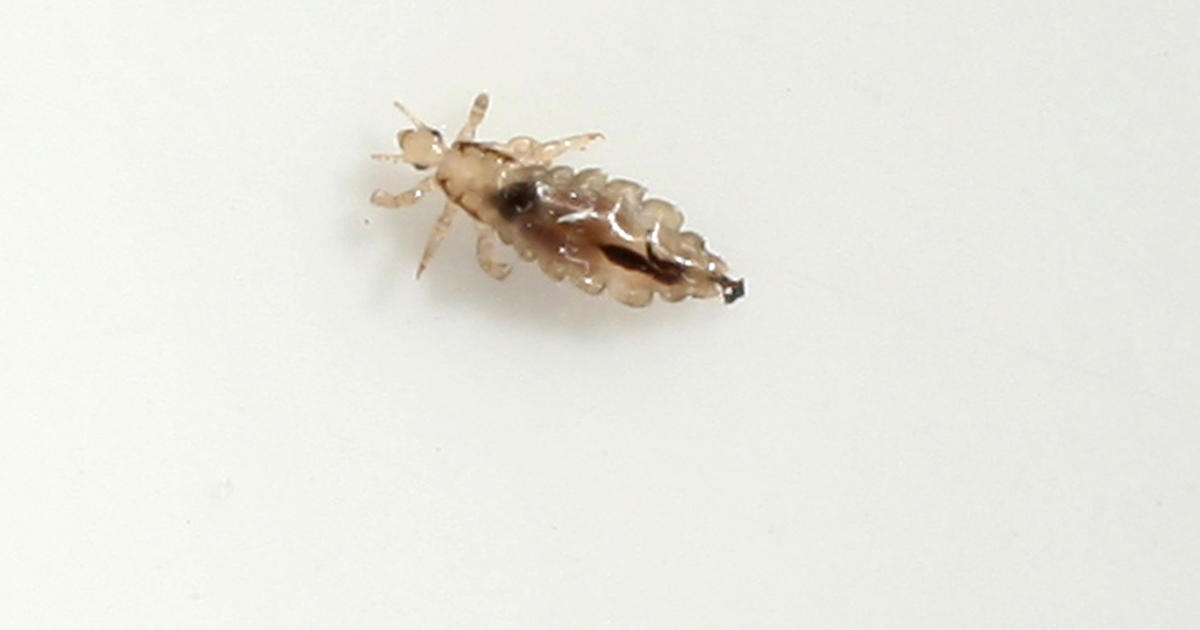 Should kids with head lice be allowed at school? - CBS News