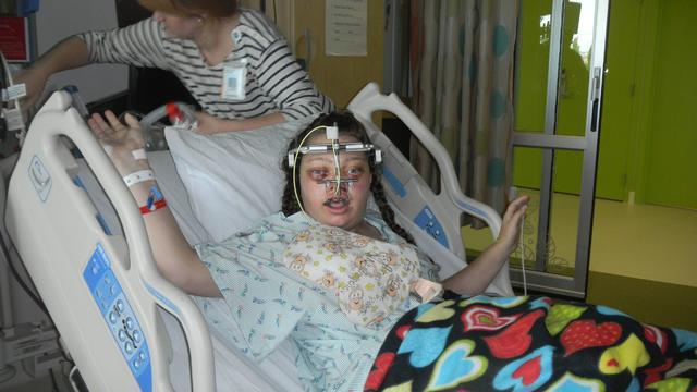 post surgery with arms out.JPG 