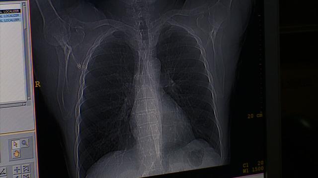 lung2.jpg 