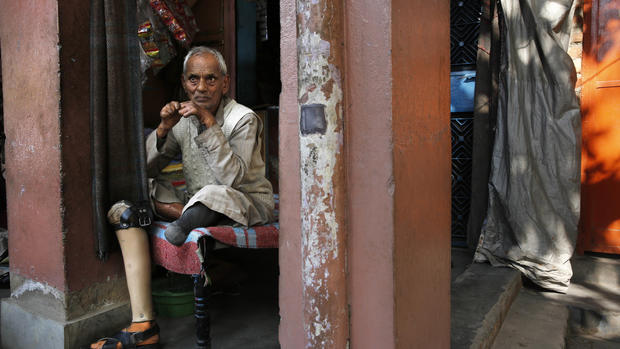 Leprosy's enduring stigma 