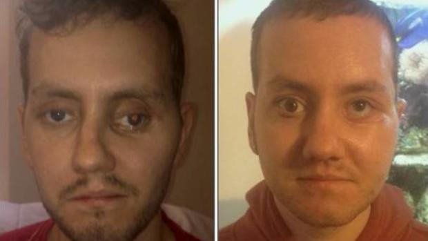 Face reconstructed with 3D printer 