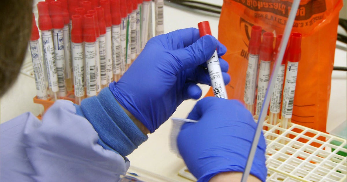 Antibiotic-resistant "superbugs" spread worldwide - CBS News