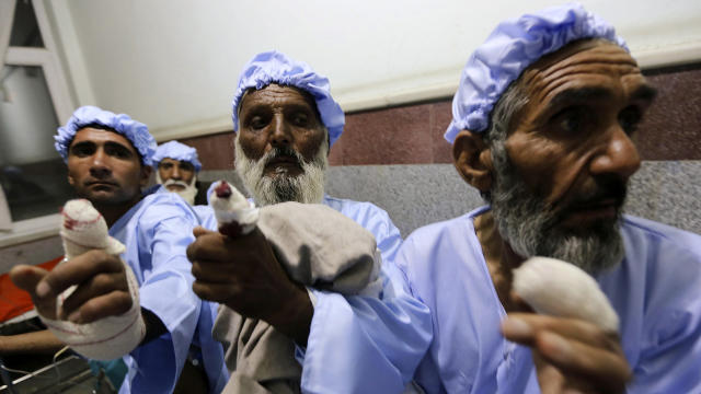 Men show their fingers after the ink-stained part of their fingers were cut off by the Taliban after the men took part in Afghanistan's presidential election in Herat province June 14, 2014. 