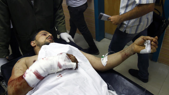 Doctors rush an injured man into a hospital following an explosion at a subway station in Cairo 