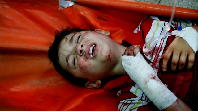 injuredboyap255337669715.jpg 