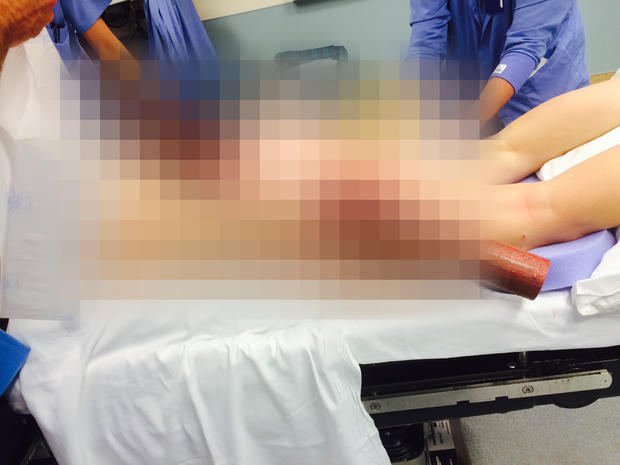 Texting Impaled Woman 