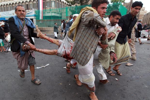 Yemeni militiamen carry victim of suicide blast 