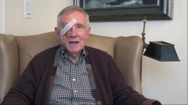 reid-closer-shot-of-banged-up-face.jpg 