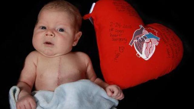 congenital-heart-defect.jpg 