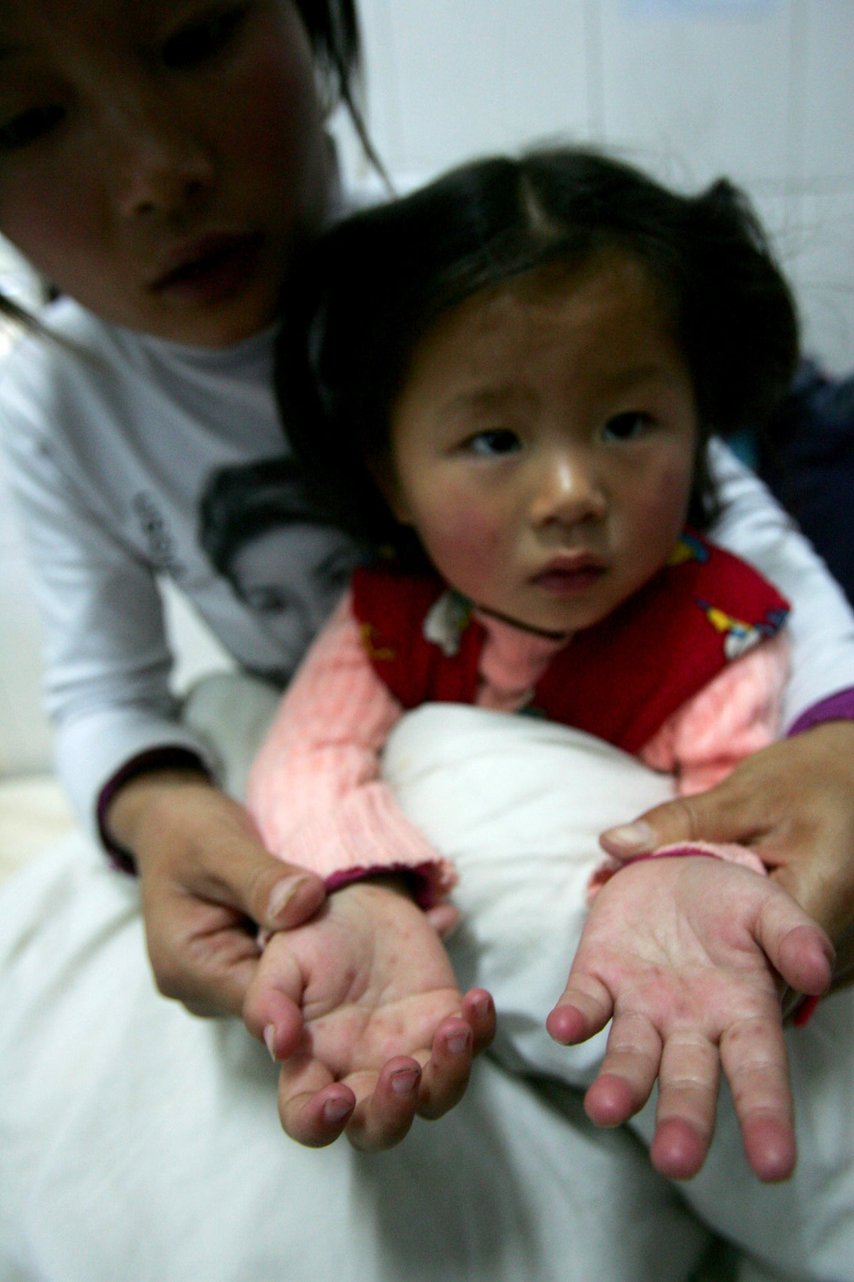 Could Essential Oils Cure Your Hand, Foot, And Mouth Disease? - c8vo9xg