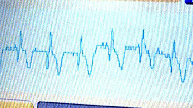 heartbeat monitor EKG 