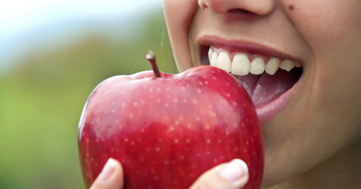 Does An Apple A Day Really Keep The Doctor Away CBS News