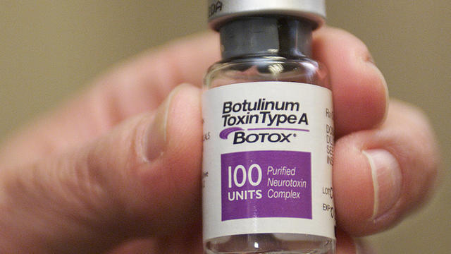 File photo shows a vial of Botox, made by Allergan, in Beverly Hills, Calif. 