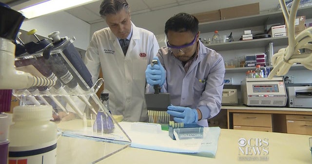 Irritable bowel syndrome New blood tests could help patients with IBS CBS News