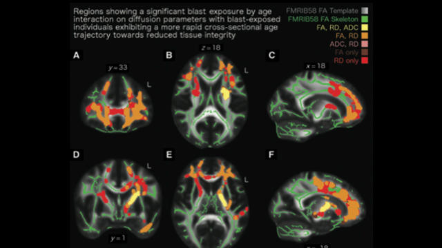 brain-scans.jpg 