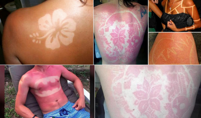 Dangerous sunburn tattoo trend goes viral as people ditch sun cream to  create red shapes on their bodies  The Sun  The Sun