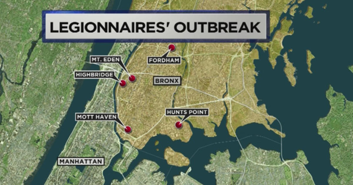 Five Facts About Legionnaires' Disease CBS New York