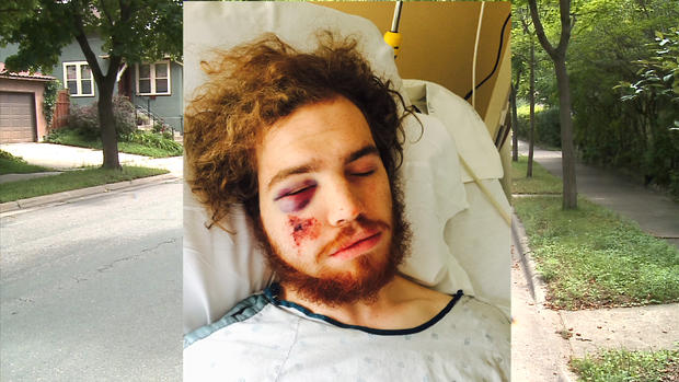 Cyclist Attacked Mackenzie Jensen Minneapolis 