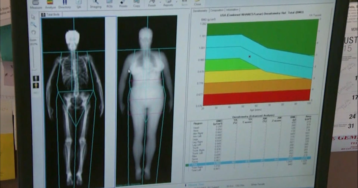 Fat scanner may give better picture of health CBS News