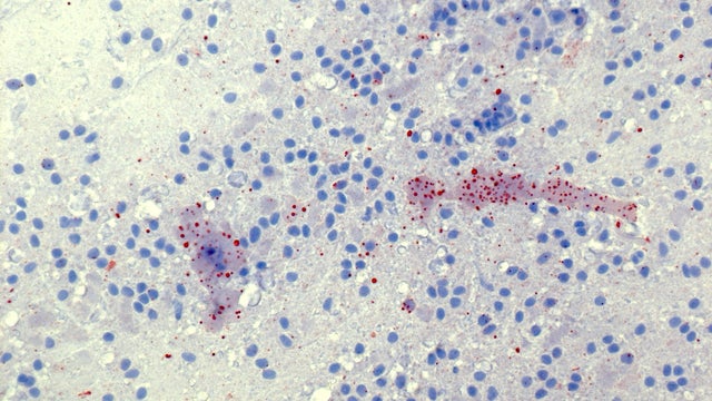 rabies-test-slide.jpg 