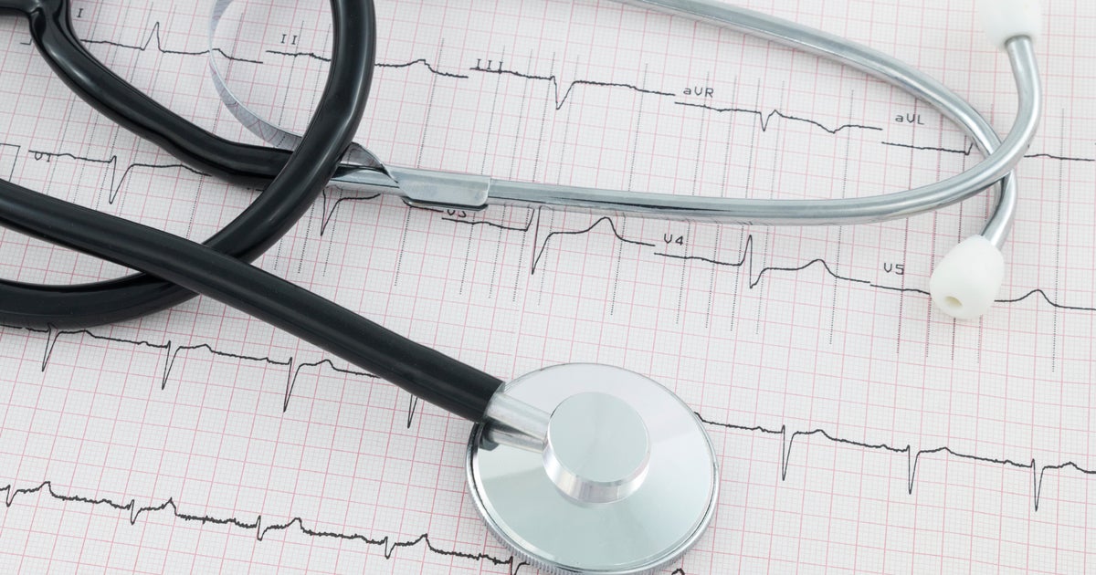 Data shows strokes are more common in African Americans Data shows strokes are more common in African Americans