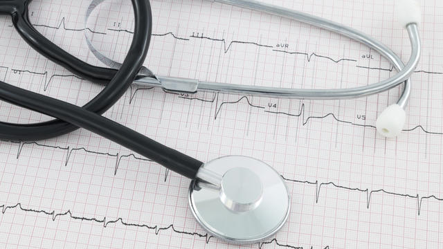 stethoscope-ekg-heart-health.jpg 