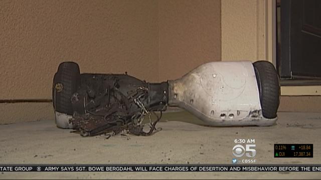 hoverboard_catches_fire_brentwood_121515.jpg 