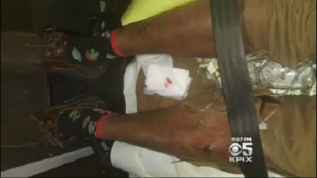 SFPD Cyclist Beating 