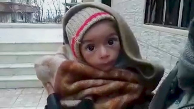 "Starvation as a weapon of war" in Syria