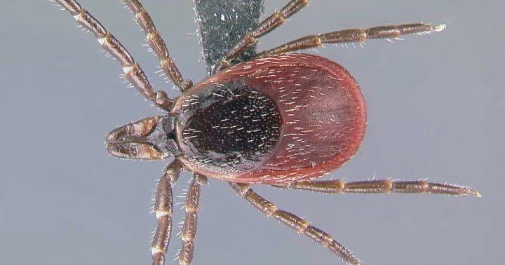 New test could spot Lyme disease much faster CBS News