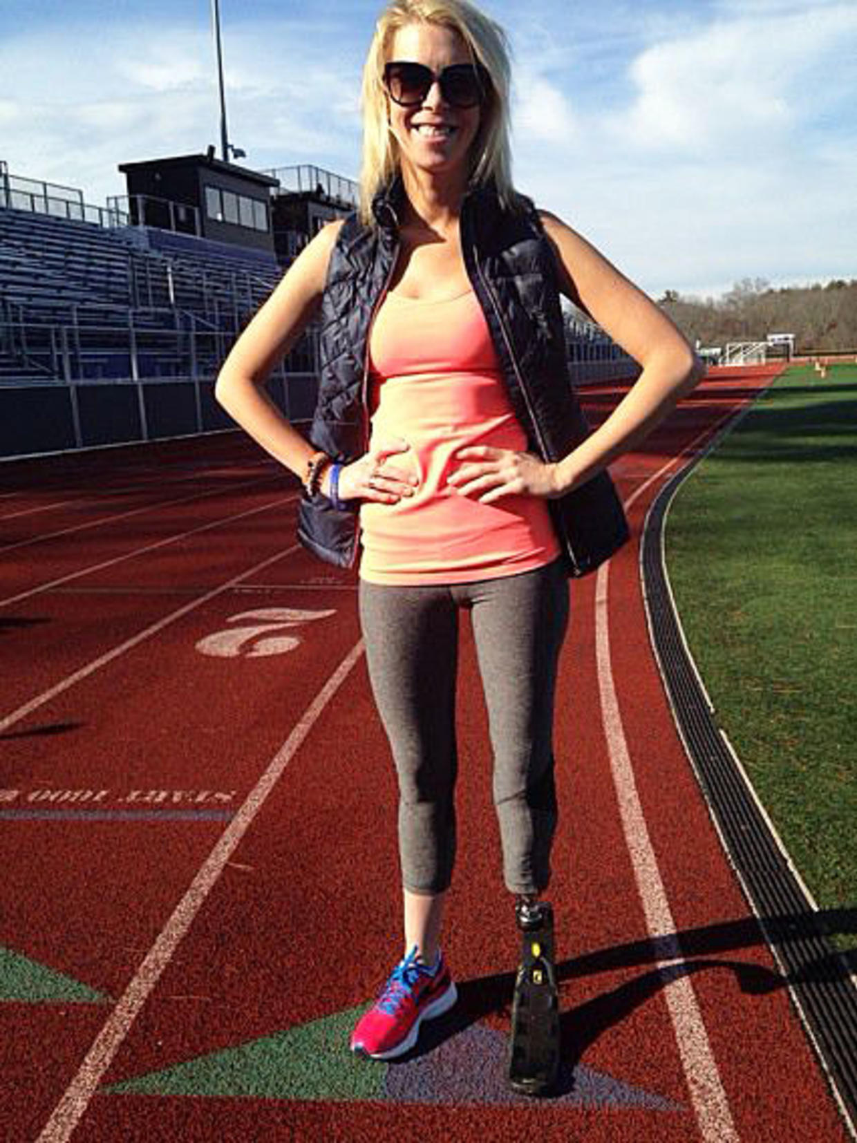 Bombings Survivor Adrianne Haslet To Run Boston Marathon CBS Boston