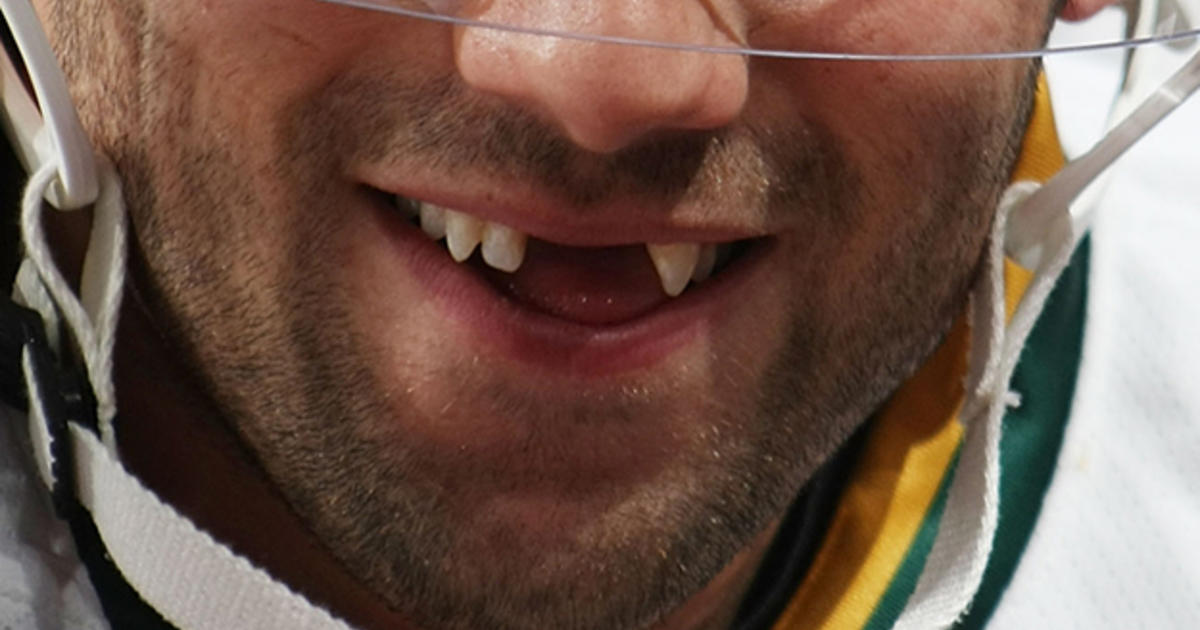 For NHL players, teeth come and go regularly