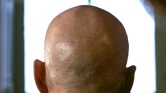 bald-head-52973504.jpg 