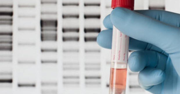 DNA leads to arrest in mom's 1977 cold case rape, murder - CBS News