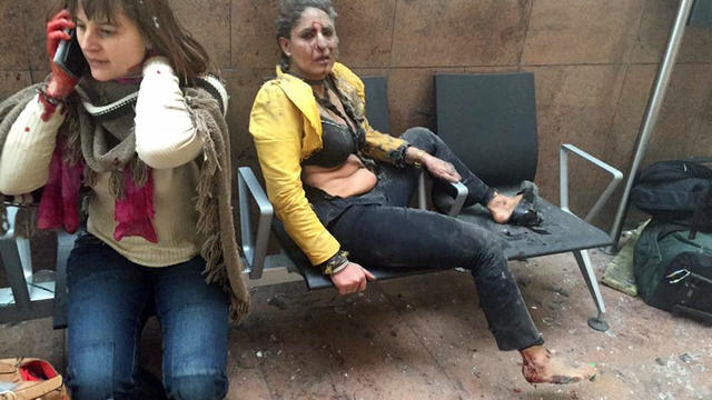 In this photo provided by Georgian Public Broadcaster and photographed by Ketevan Kardava, two women are seen wounded in Brussels' airport in Belgium after two explosions March 22, 2016. 