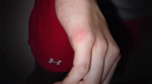 Police photographed marks on Taylor Gould's hand 