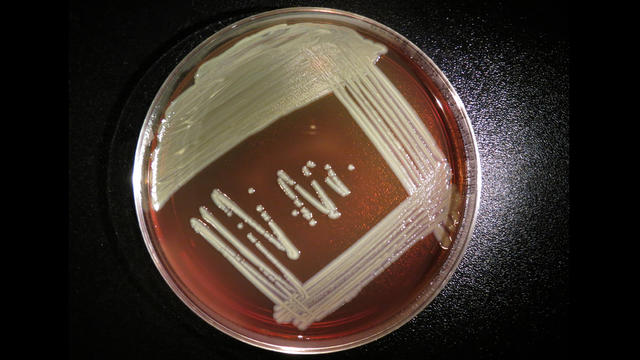 elizabethkingia-bacteria.jpg 