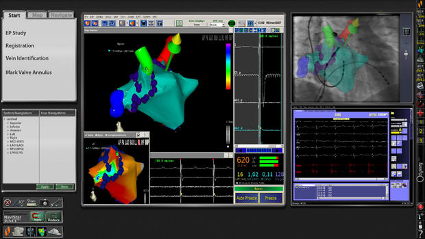 Electrophysiology User Interface 