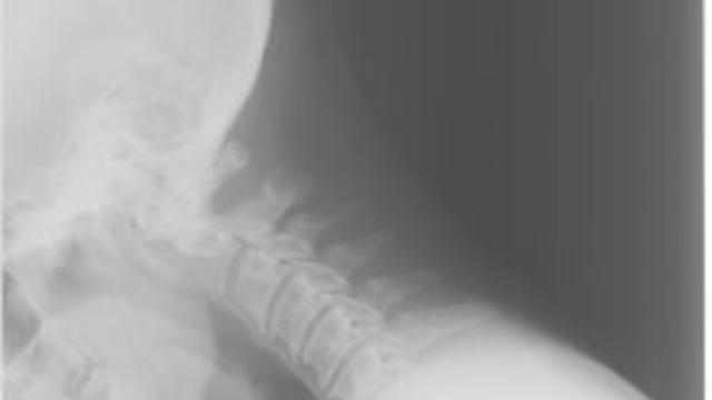 neck-x-ray.jpg 