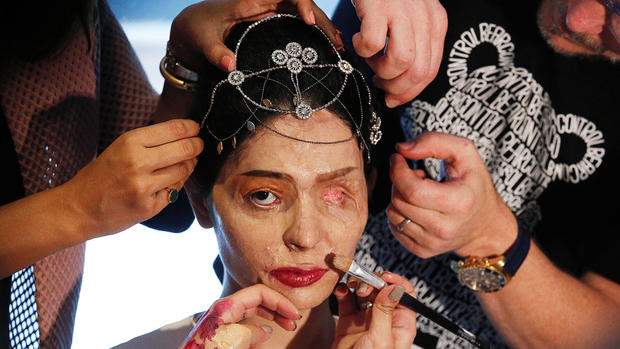 Acid attack survivor takes on NY Fashion Week 